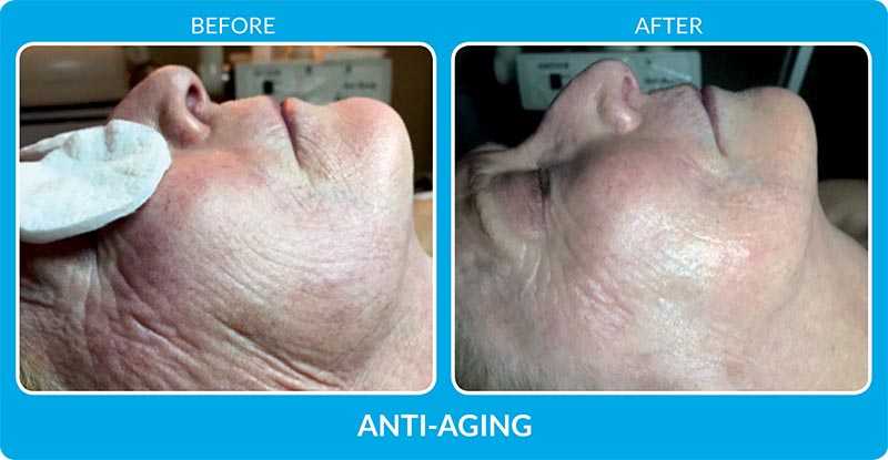 AntiAging_B_A-001