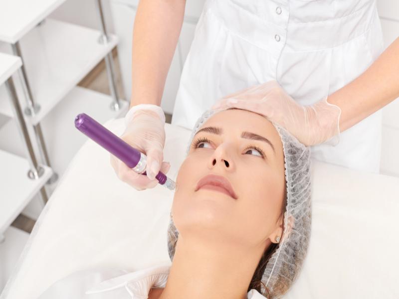 Who Offers the Best Microneedling in Southeast Michigan?