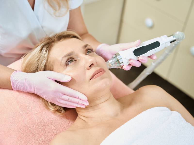 Should I Choose Microneedling or Chemical Peels for My Skin?
